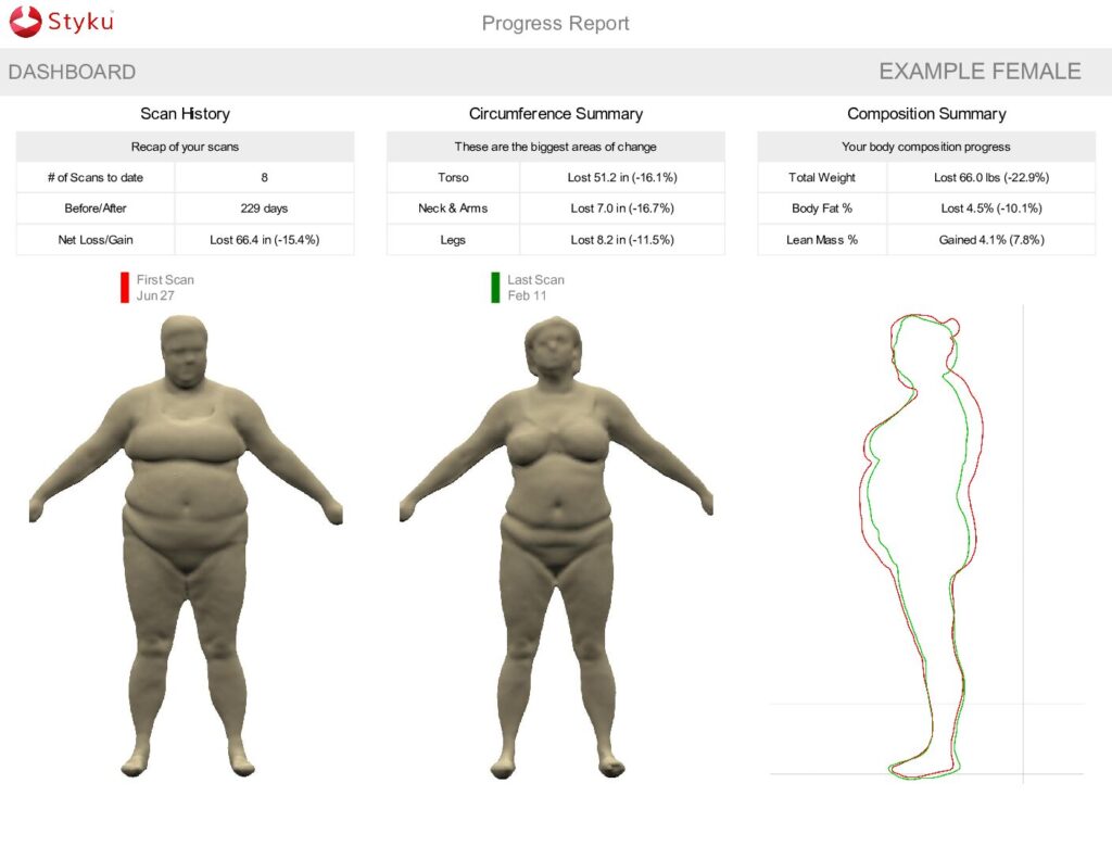 Styku 2D Body Scan Report Sample